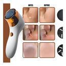 Esfoliador Elétrico Pés Portátil Pés Macios Remove Calos -